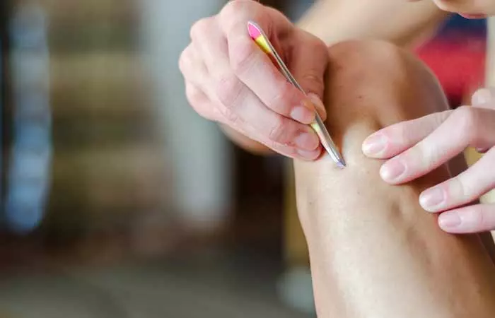 You-Can-Avoid-Ingrown-Hairs