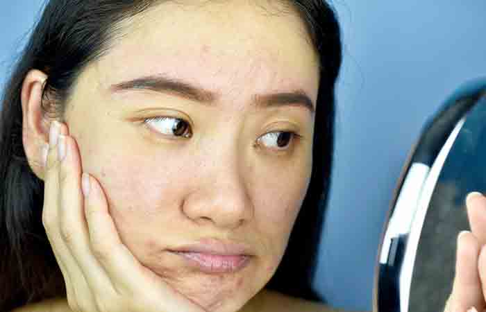 Woman with pigmented skin may benefit from moringa