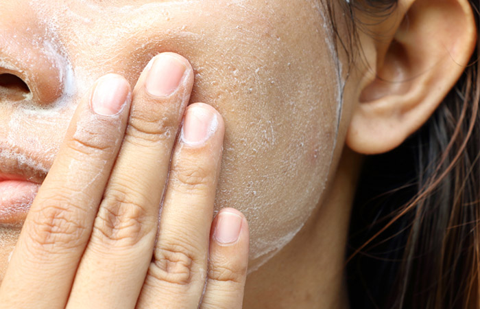 Exfoliation reduces fungal acne risk