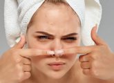 नाक पर कील मुंहासे होने के कारण और घरेलू उपाय - How to Remove ...