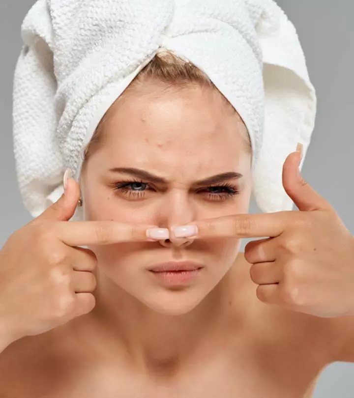 नाक पर कील मुंहासे होने के कारण और घरेलू उपाय – How to Remove Pimples on Nose in Hindi