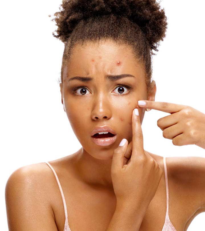 What Is Hydrocortisone? Does It Work For Acne?
