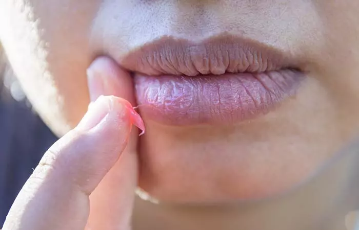 It May Cause Irritation To The Skin Surrounding Your Lips