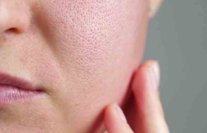 Woman with open pores may benefit from moringa