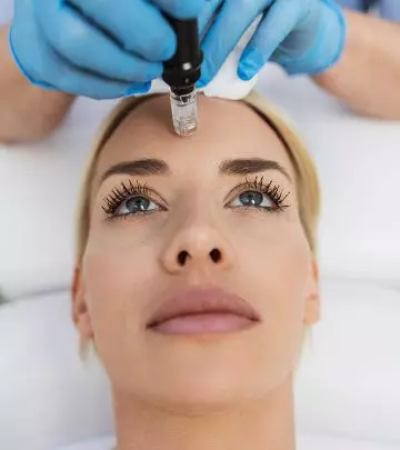 Microneedling Aftercare Tips, Potential Side Effects