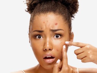 Tretinoin For Acne