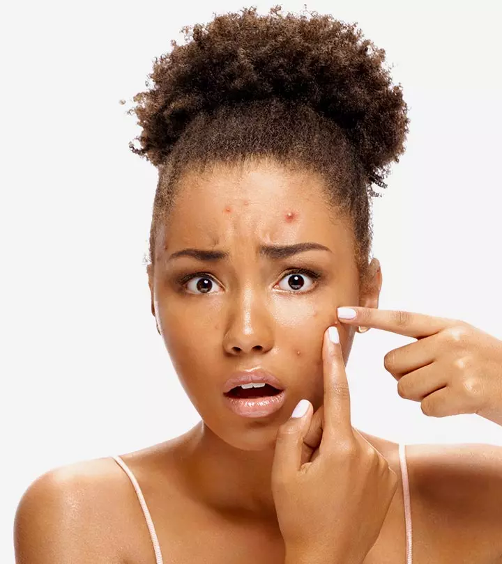 Benefits Of Tretinoin For Acne
