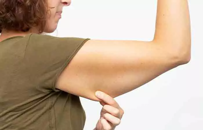 Woman pinches sagging arm skin that has lost firmness