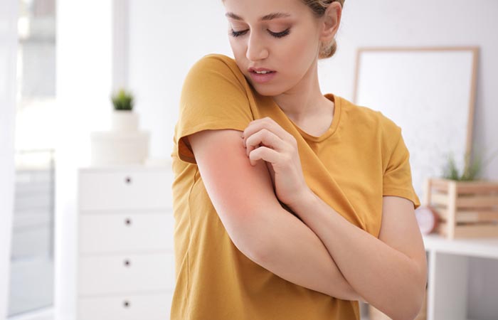 Woman experiencing allergies due to metformin
