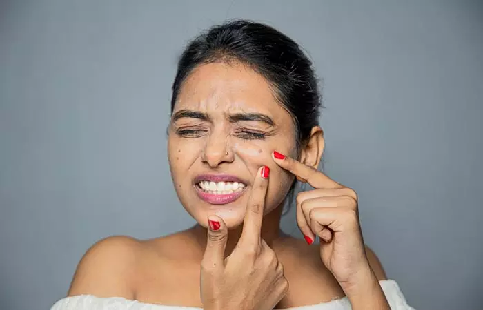 Woman thinking of applying Vicks on her acne