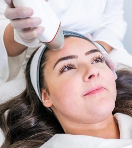 Everything You Need To Know About RF Microneedling