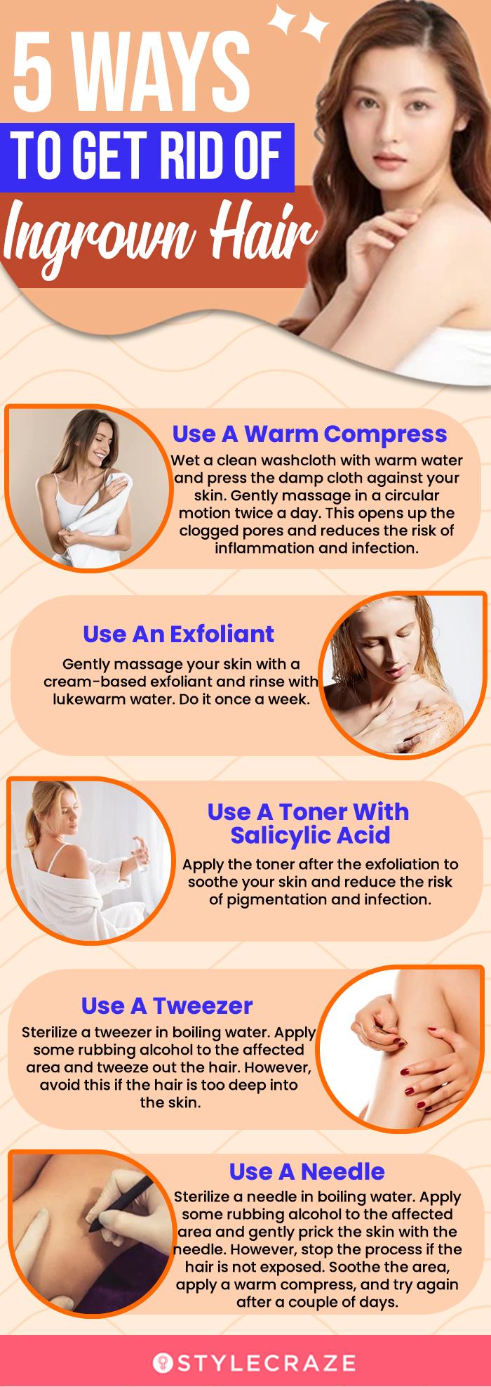 5 ways to get rid of ingrown hair (infographic)