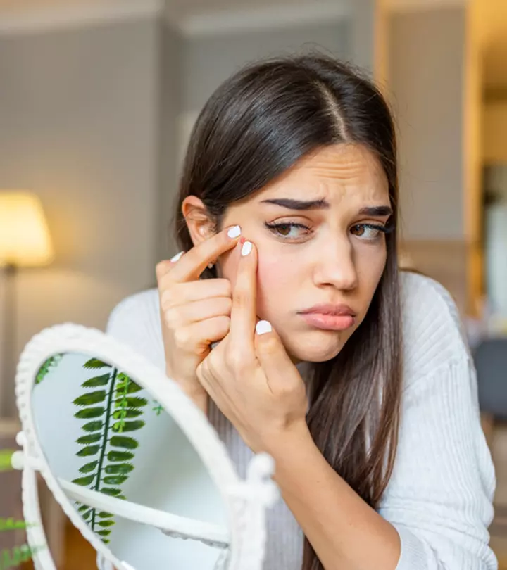 9 Steps To Prevent Acne Scarring If You’ve Popped Your Pimple