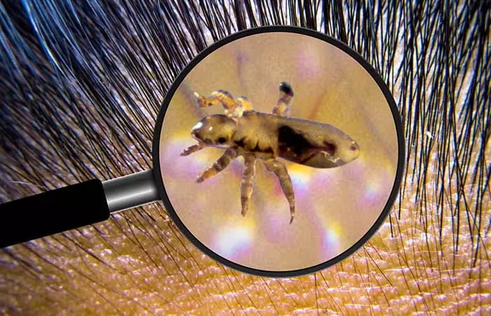 Can Lower Your Risk Of Encountering Lice