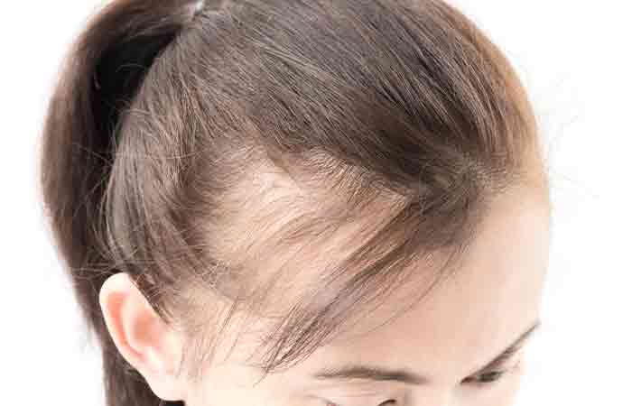 Thinking Of Hair Transplantation? Here Are The Side Effects