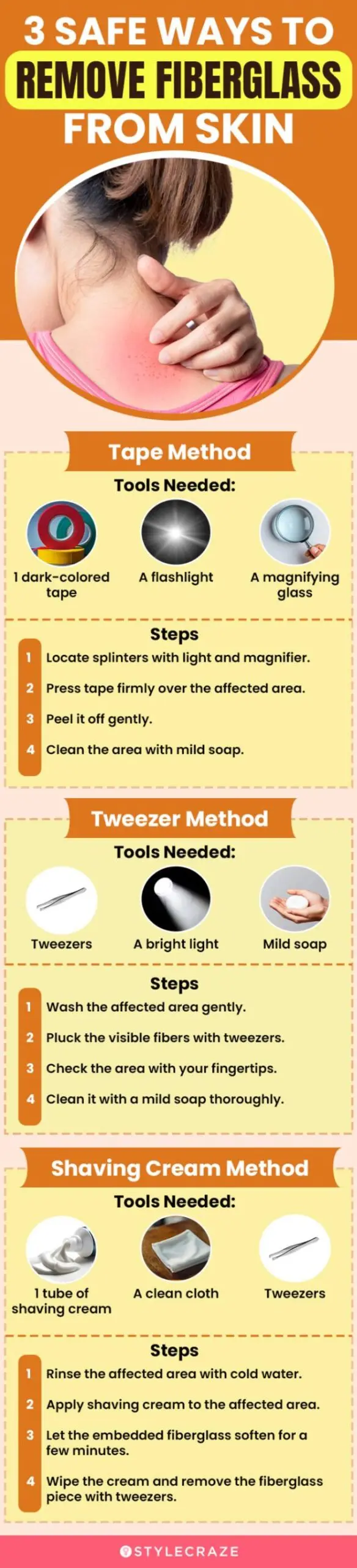 3 safe ways to remove fiberglass from skin (infographic)