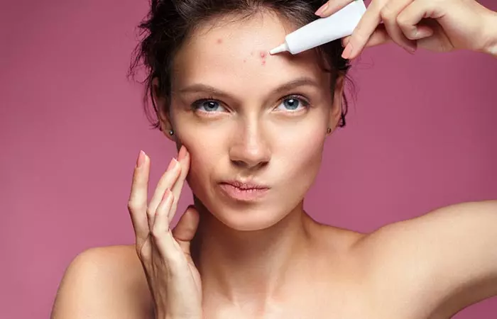 Opt for acne-specific products to treat and manage flare-ups