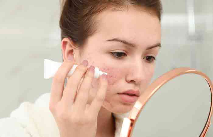 Antimicrobial property of vitamin D may help soothe acne