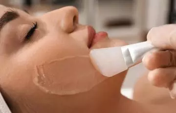 Woman getting a chemical peel done for its anti-aging effects
