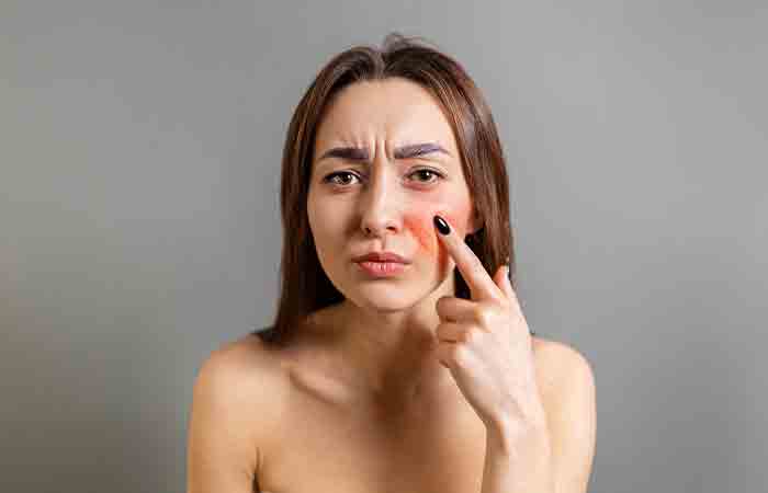 Women with sensitive skin should not use citric acid