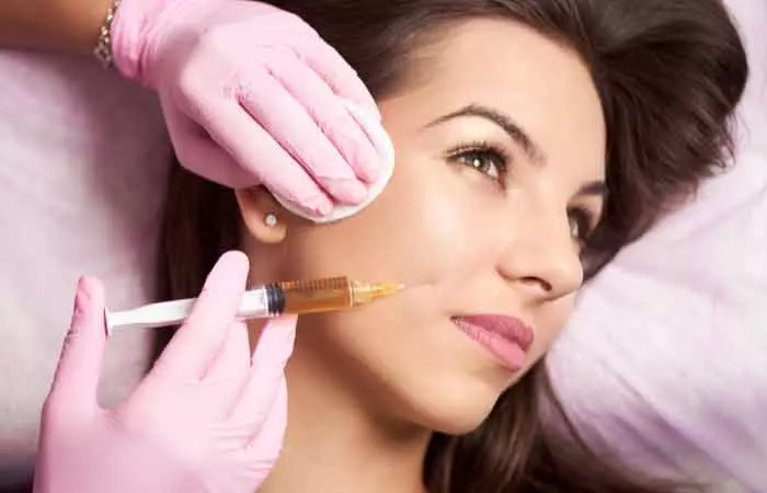 Dermal-Fillers