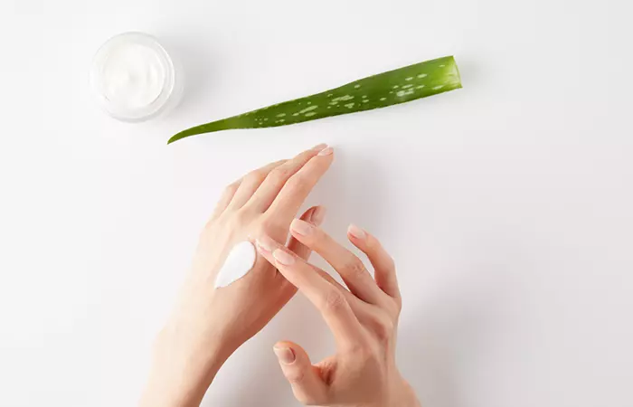 Woman applying aloe vera gel mixed with moisturizer to stop itching