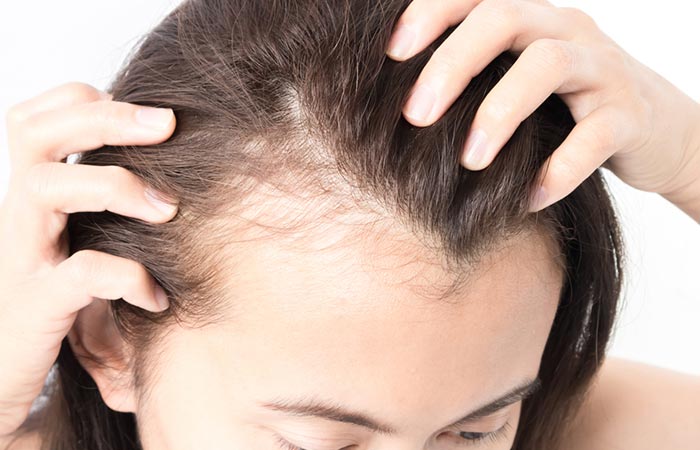 Alpecin caffeine shampoo causes hair thinning