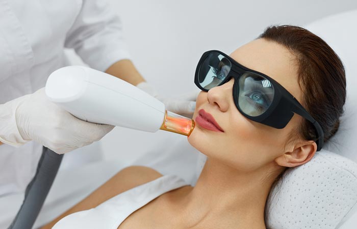 Woman getting a laser resurfacing anti-aging treatment done