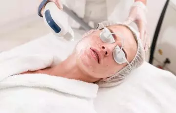 Woman undergoing laser treatment for nodular acne