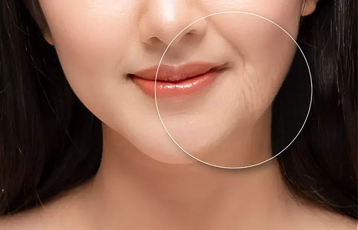 Woman with aging skin may benefit from amino acids