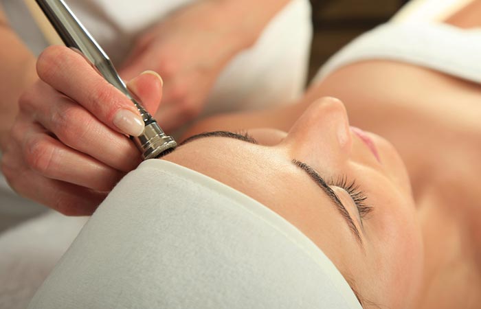 Woman getting a microdermabrasion anti-aging treatment done