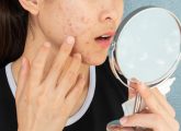 Nodular Acne: Causes, Treatment Options, & Home Remedies