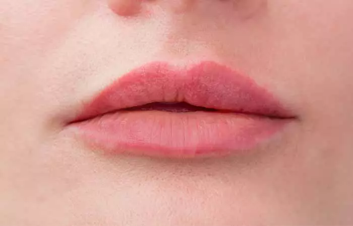 Lip fillers may make your lips asymmetrical