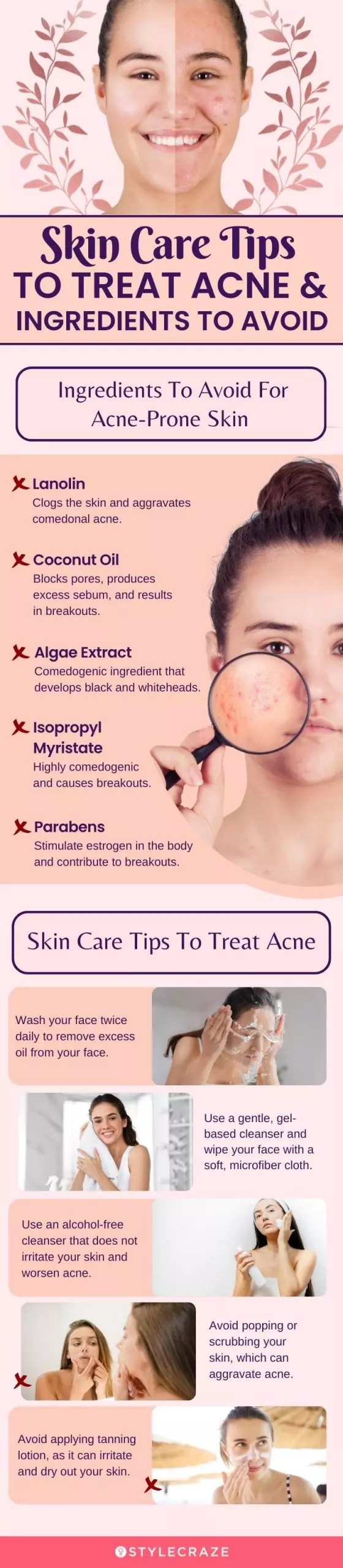 Skin Care Tips To Treat Acne & Ingredients To Avoid