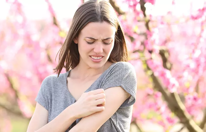 Woman scratching skin may have ingrown hair scars