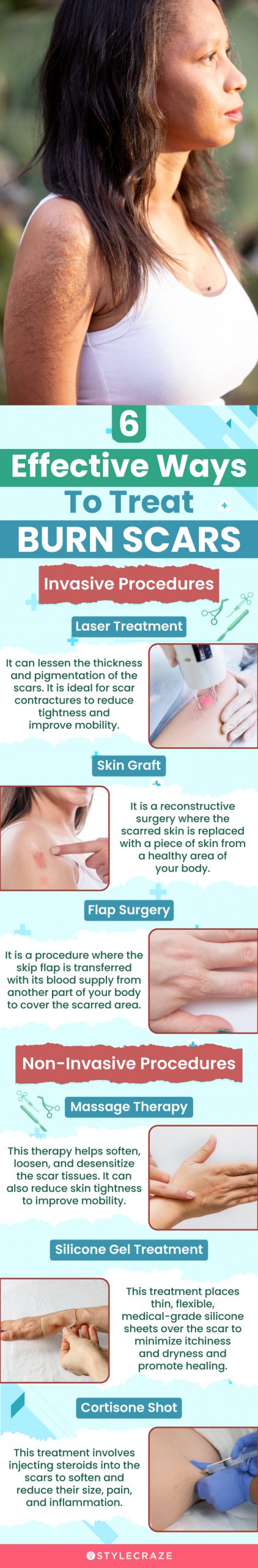 6 effective ways to treat burn scars (infographic)