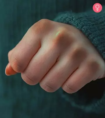 A girl showing her dark knuckles