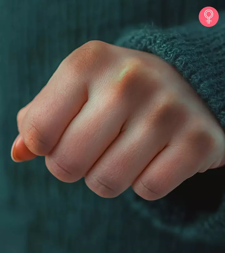 A girl showing her dark knuckles