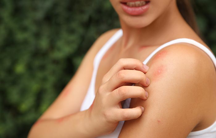  Allergic reaction causes skin inflammation