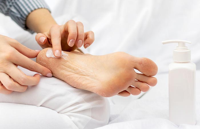 Woman moisturizing her feet at home to treat peeling skin