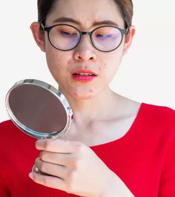 Woman Using Retinol For Acne