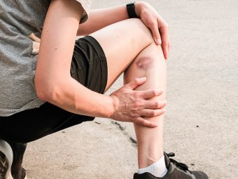 Can Essential Oils Heal Bruises