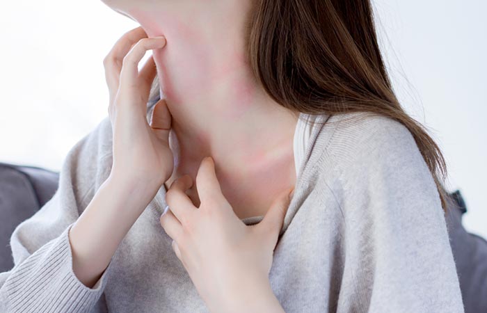 Dysfunctional immune system triggers skin inflammation