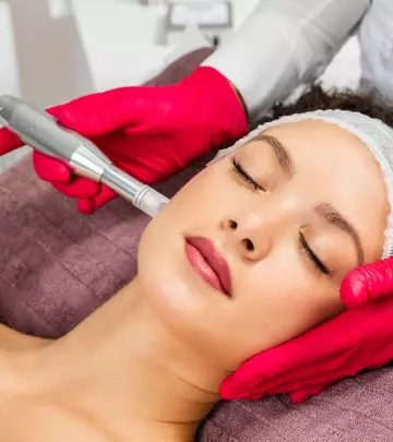 What Is Microneedling? Its Benefits, Side Effects, And More