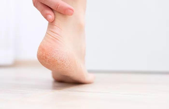 Epsom salt foot soak helps exfoliate your feet