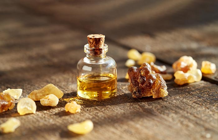 Frankincense oil to reduce bruises