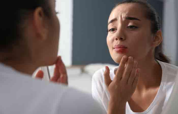 Goldenseal helps treat herpes