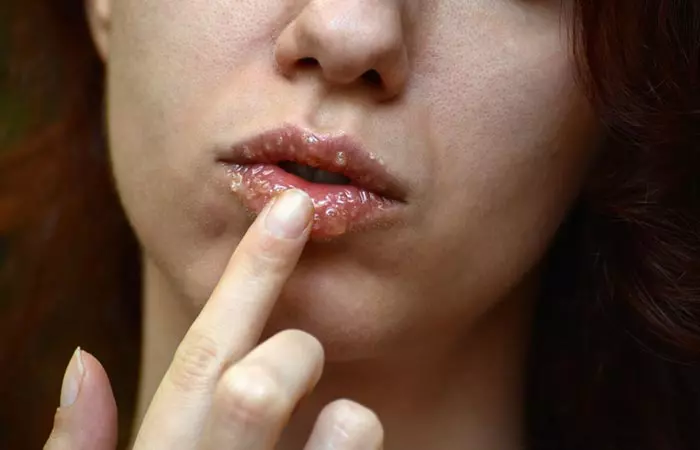 Woman exfoliating dead skin on lips