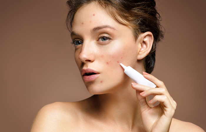 Use hydroquinone products like creams, serums, and lotions