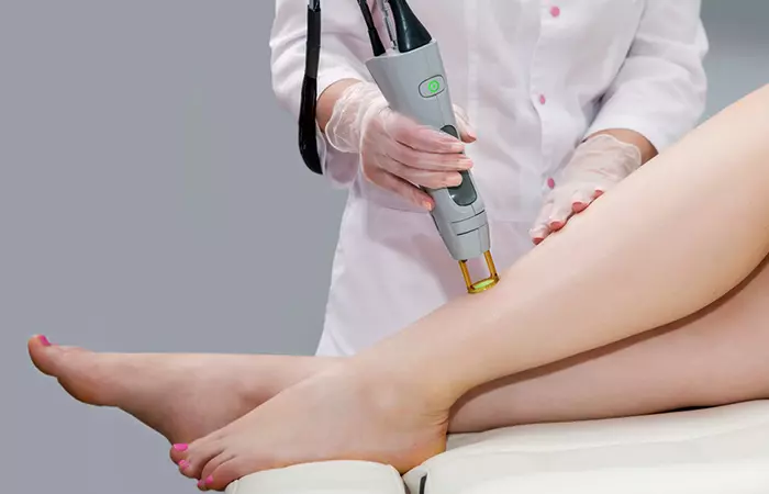 Wonan undergoing laser therapy to treat dark spots on the legs